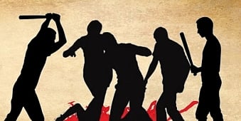 Image used for representational purpose only.