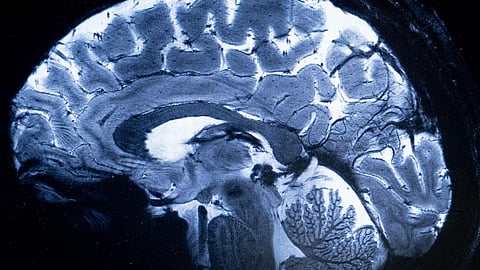 Authorities revealed that the patient had been working in Kannur about a month ago, raising concerns about possible exposure to sources outside his native place.