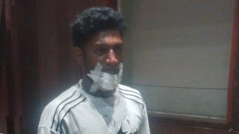 S Ashwin, a state - level Kabadi player was injured by a police attack in Coimbatore.