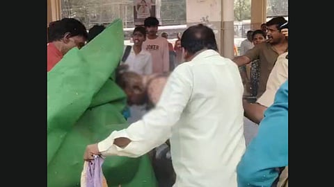 In a video, people present at the protest are seen dousing the flames and taking first aid measures.