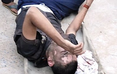 The injured youth Rajesh Dashore