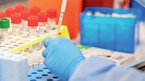 The second Sudanese national, a 22-year-old student, was shifted to Gandhi Hospital from Apollo Hospital, Nanakramguda, after developing fever while under quarantine.