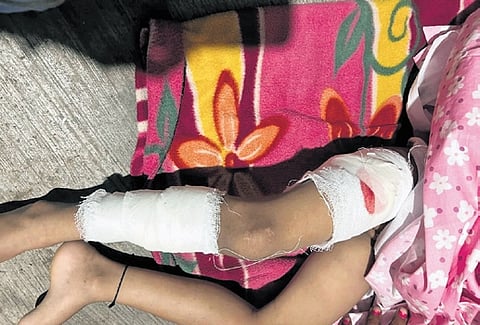 Sangeetha sustained injuries in five places on her body