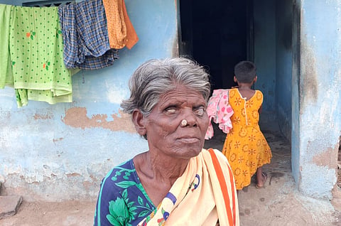S Pandiyammal, a 60-year-old visually challenged woman from Katchaikatti area Vadipatti taluk.