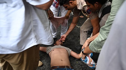 An injured Cockroach Janata Party (CJP) supporter during a protest march, at Sansad Marg, in New Delhi, Monday, July 20, 2026.