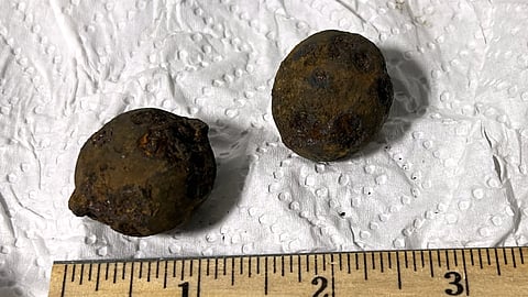 This photo provided by the Transportation Security Administration (TSA) shows two stolen Civil War-era cannonballs discovered by TSA officers in a checked bag at the Gulf Shores International Airport in Gulf Shores, Ala., on July 18, 2026.