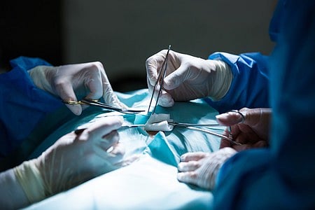 The baby received a 62-gram liver graft donated by his mother.