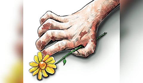 leprosy