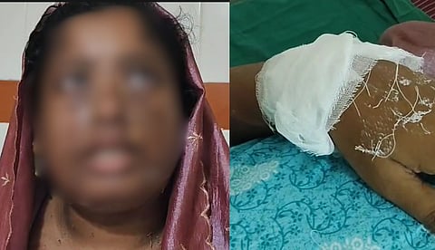 ഉസ്താദ് നിര്ദേശിച്ച ആഭിചാര ക്രിയയ്ക്ക് കൂട്ടുനിന്നില്ല; കൊല്ലത്ത് യുവതിയുടെ മുഖത്ത് തിളച്ച മീന്കറി ഒഴിച്ച് പൊള്ളിച്ച് ഭര്ത്താവ്