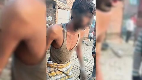 Man Tied To Pole Set On Fire After Dispute Over Prayers In UP Mosque