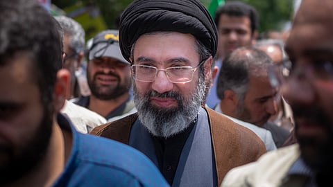 Mojtaba Khamenei's face burned