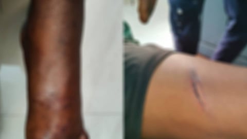 Child labor and abuse at Snehathanal Nursing Home