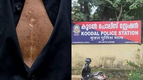 "ബൈപ്പാസ് കഴിഞ്ഞ ആളാണെന്ന് പറഞ്ഞിട്ടും മർദിച്ചു, കാലിൽ ബൂട്ടിട്ട് ചവിട്ടിയരച്ചു"; കോന്നിയിലെ വ്യാജപീഡന കേസിൽ പൊലീസിനെതിരെ യുവാവ്