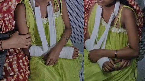 അഞ്ചാം ക്ലാസുകാരിയുടെ കൈ തല്ലിയൊടിച്ച് അധ്യാപകന്; പ്രകോപനം ഹോംവര്ക്ക് ചെയ്യാത്തതിന്