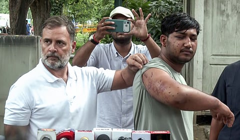പരിക്കേറ്റ വിദ്യാര്ഥികള്ക്കൊപ്പം രാഹുല് ഗാന്ധി