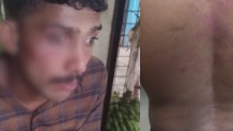മലപ്പുറത്ത് മര്ദനത്തിനിരയായ ഭിന്നശേഷിക്കാരനെതിരെ പോക്സോ കേസ്