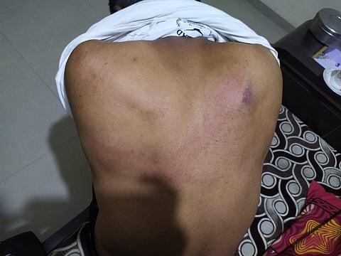 मुख्याध्यापकावर जीवघेणा हल्ला