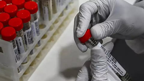 RT-PCR चाचण्या वाढविण्यासह अॅक्टिव्ह सर्व्हिलन्स सुरू करण्याचे केंद्राचे राज्यांना निर्देश