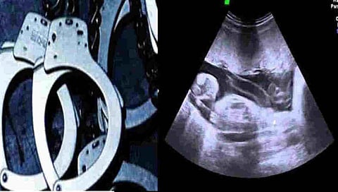 Kolhapur Pregnancy Diagnosis : बेकायदा गर्भलिंग निदान, गर्भपातप्रकरणी डॉक्टरला अटक