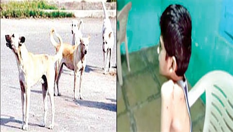 नाशकात मोकाट कुत्र्यांचा सुळसुळाट ; दहा वर्षीय मुलावर हल्ला
