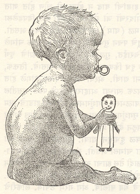 लॉकडाउननंतर यंदा मुडदूसचे रुग्ण वाढले