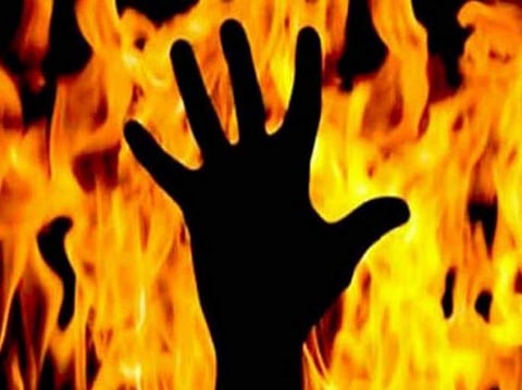 burn injuries