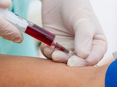 Lab-grown blood : प्रयोगशाळेमध्ये निर्मित रक्ताची मानवावर चाचणी सुरु : ब्रिटनमध्ये जगातील पहिली क्लिनिकल ट्रायल