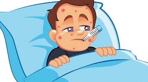 पुणे : नवीन वर्षात शहरात गोवरचे आठ रुग्ण