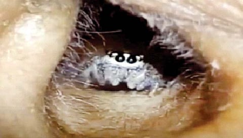 Spider