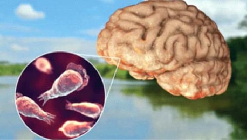 दक्षिण कोरियात मेंदू खाणार्या अमिबाची दहशत