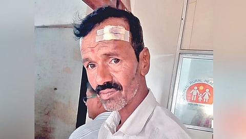 सातारा : बिबट्याचा दुचाकीस्वारावर हल्ला