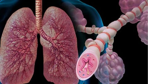 Asthama
