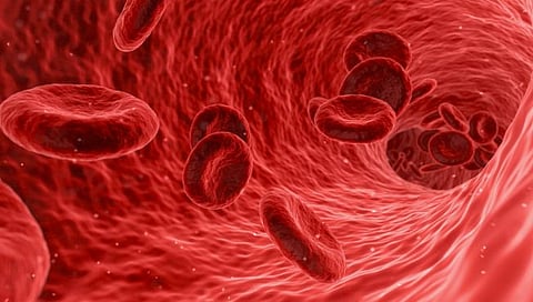 Anemia