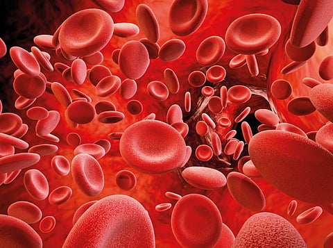 Hemophilia