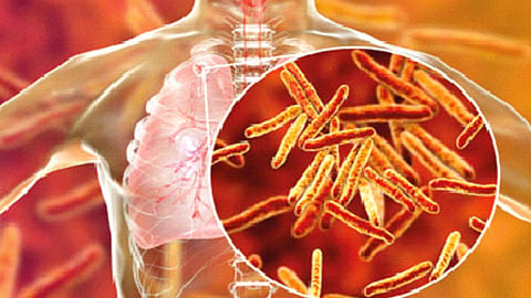 TB patients