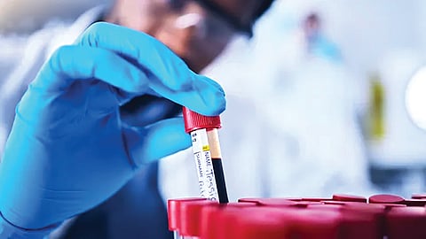 ‘एआय’ आधारित रक्तचाचणीने आठ वर्षे आधीच ऑस्टिओआर्थरायटिसचे निदान