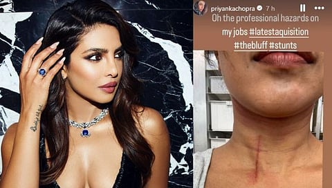 Priyanka Chopra
