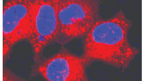 Cancer Cells