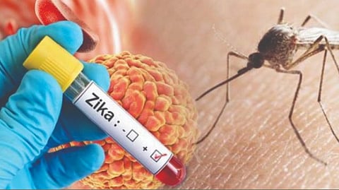 Zika Virus