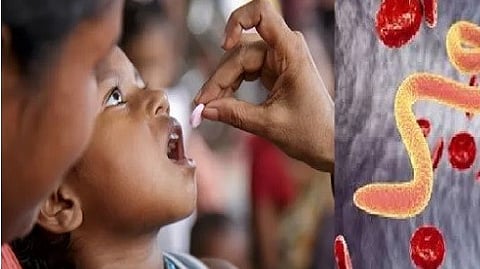 Beware! Anemia in children due to worms