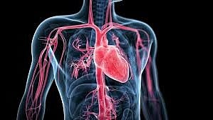 Angiography