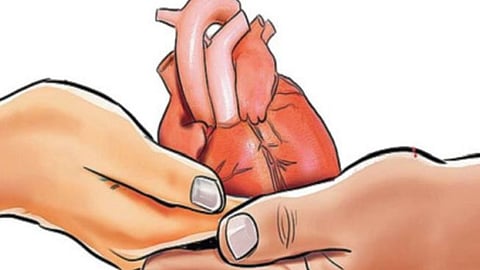 Organ transplant