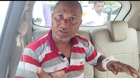 Chakur attack case