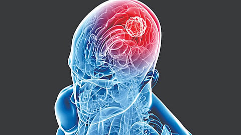 World Brain Tumor Awareness Day