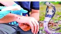 Snakebite News
