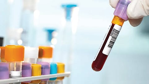 Blood Report Scam