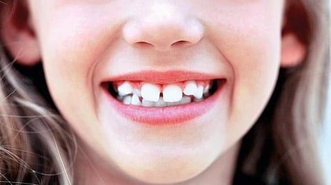 treatment for crooked teeth in children