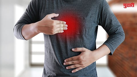 Acidity Home Remedies
