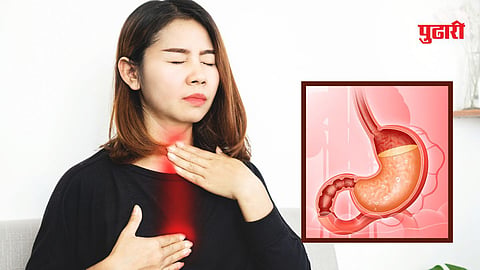 Fasting acidity remedies