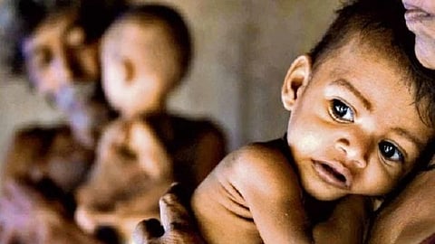 Malnutrition